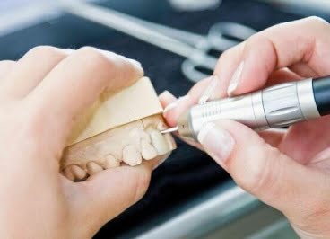 Металлокерамические коронки