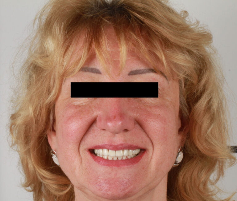 Тотальная реабилитация